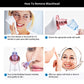 Dermazen™ - Advanced Pore Vacuum Extractor