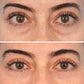 Eyelixir™- Salmon DNA Collagen Eye Patches...