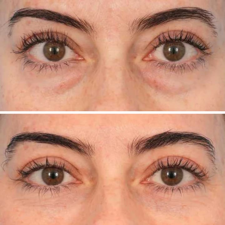 Eyelixir™- Salmon DNA Collagen Eye Patches...
